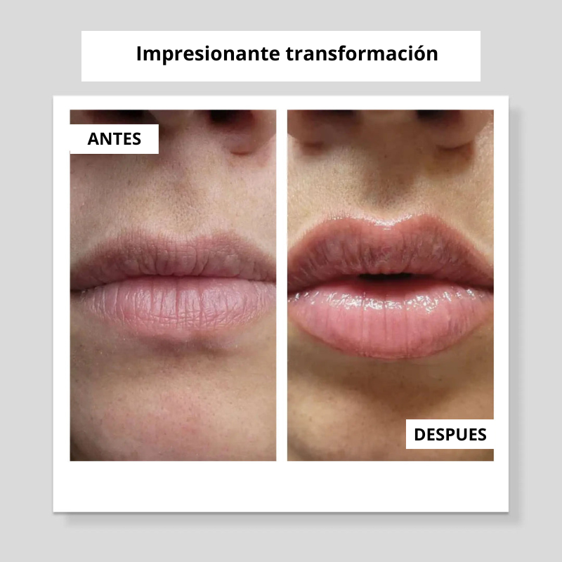 LIP GLOW KIT™