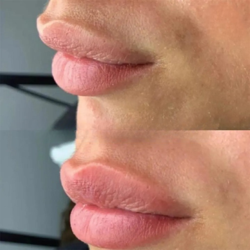 LIP GLOW KIT™