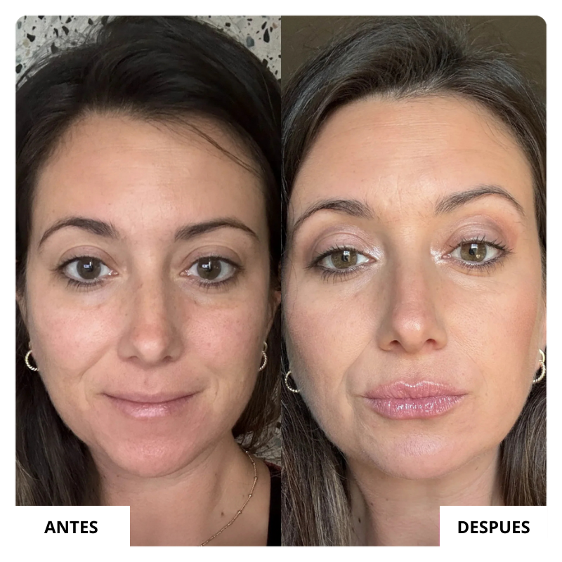 LIP GLOW KIT™