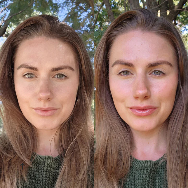 LIP GLOW KIT™