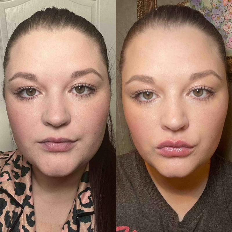 LIP GLOW KIT™