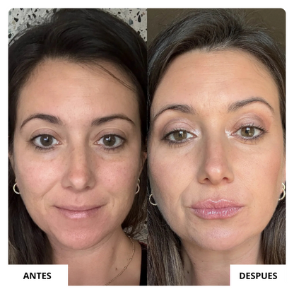 LIP GLOW KIT™